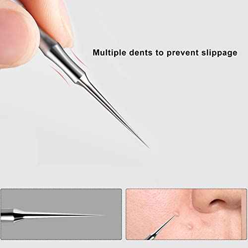 Pointed Blackhead Removal, 2-in-1 Acne Extractor Tool - Stainless Steel Whitehead Remover for Face/Nose