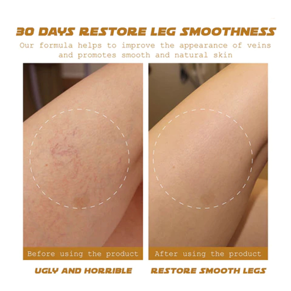 Venous Massage Cream for Sore Legs - 60g