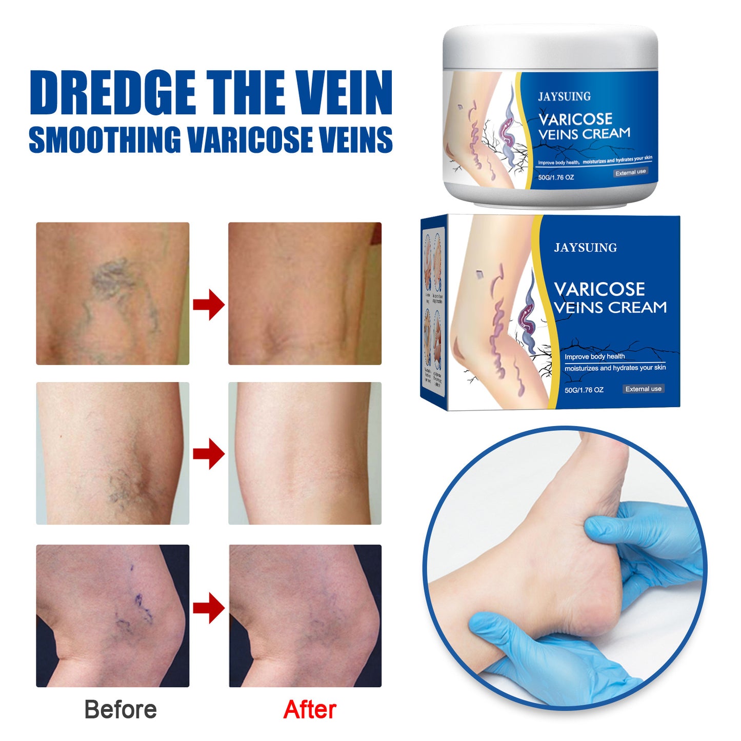 Leg Vein Repair Cream for Varicose Vein Relief and Massage