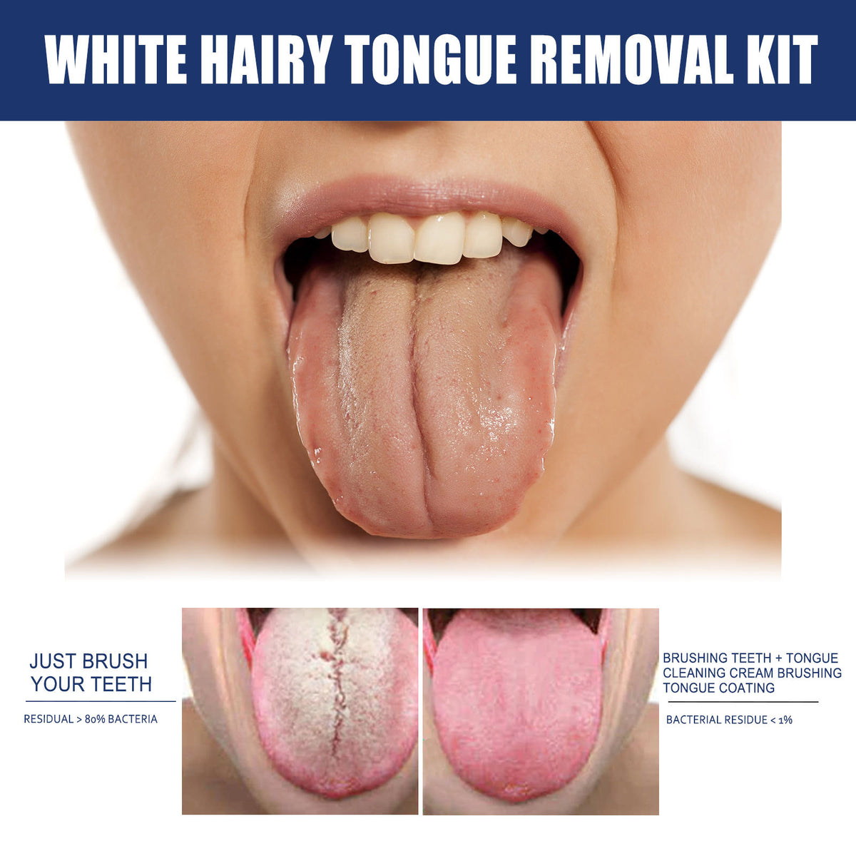 Tongue Coating Brush Clean Oral Care Remove Breath Odor