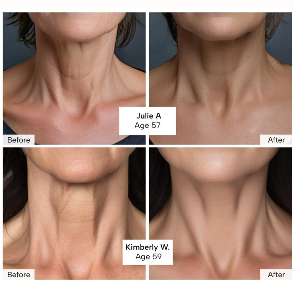 Neck Tightening Cream Moisturizes Skin