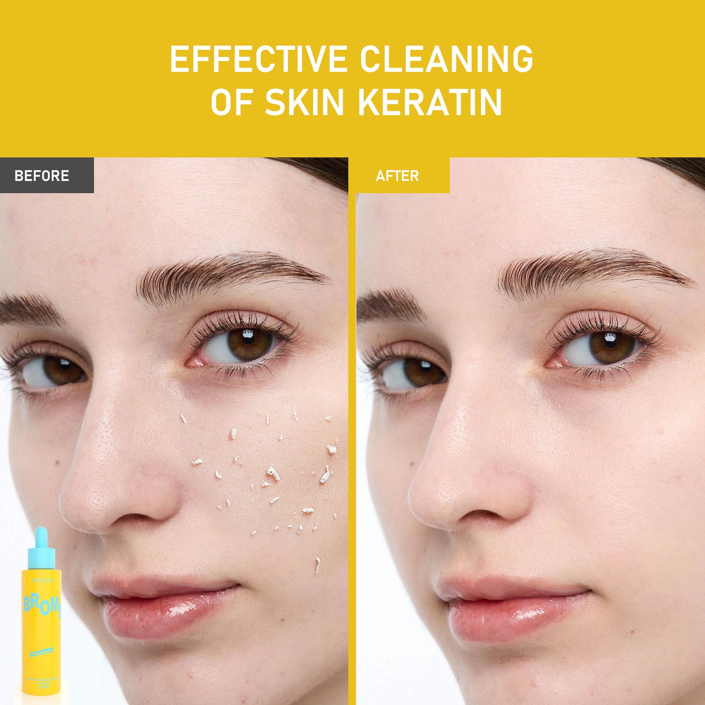 Exfoliating Facial Treatment Set - CS005