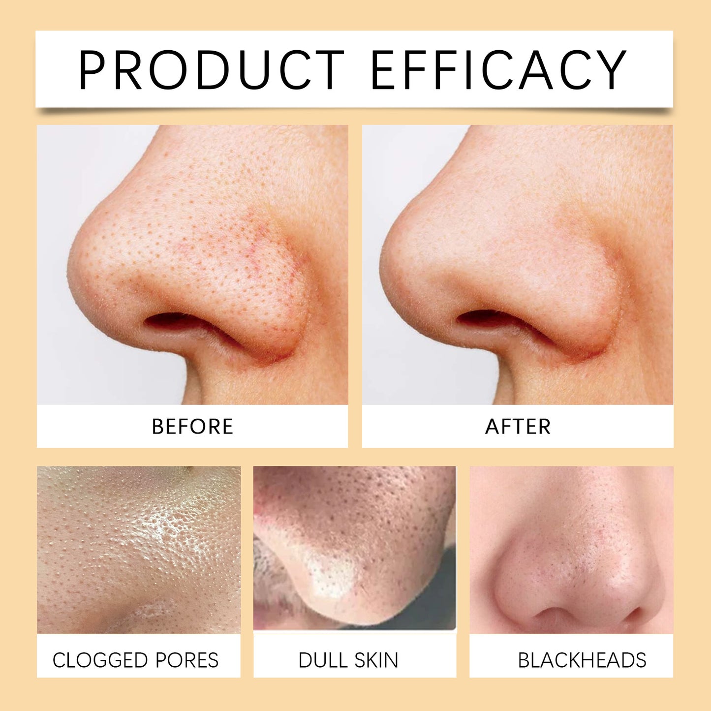 Enzymes Exfoliating Brightening Gel - Gentle Pore Cleansing & Smoothing