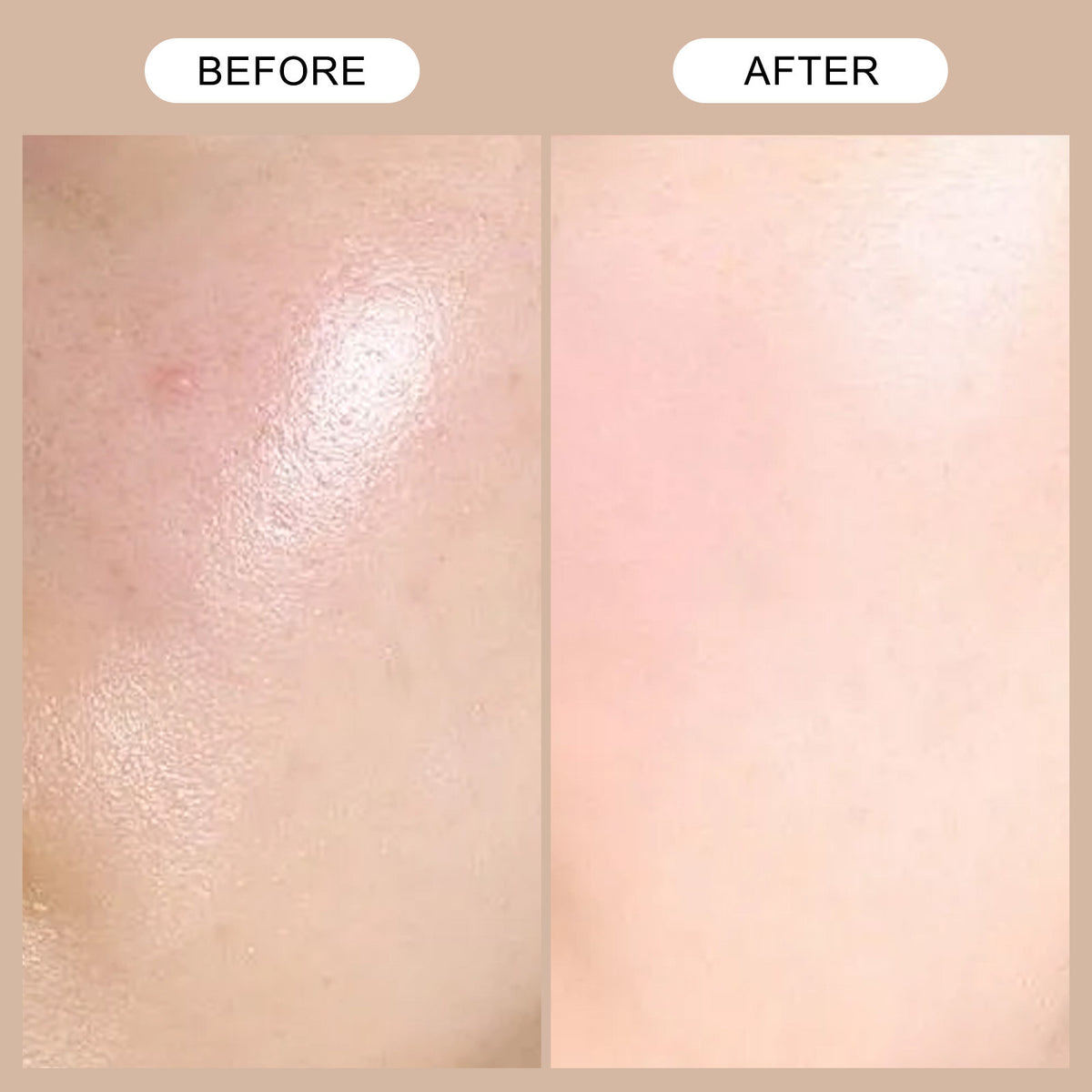 Retinol Moisturizing Serum for Face – 50ml