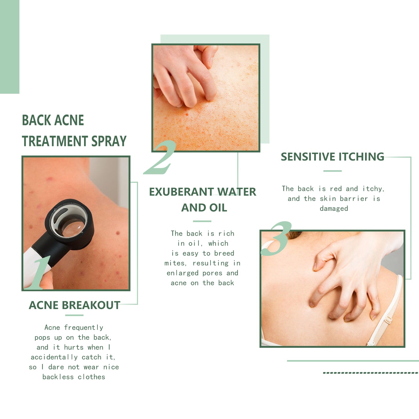 Exfoliating Body Acne Spray - Moisturizing & Skin Clearing Mist 120ml