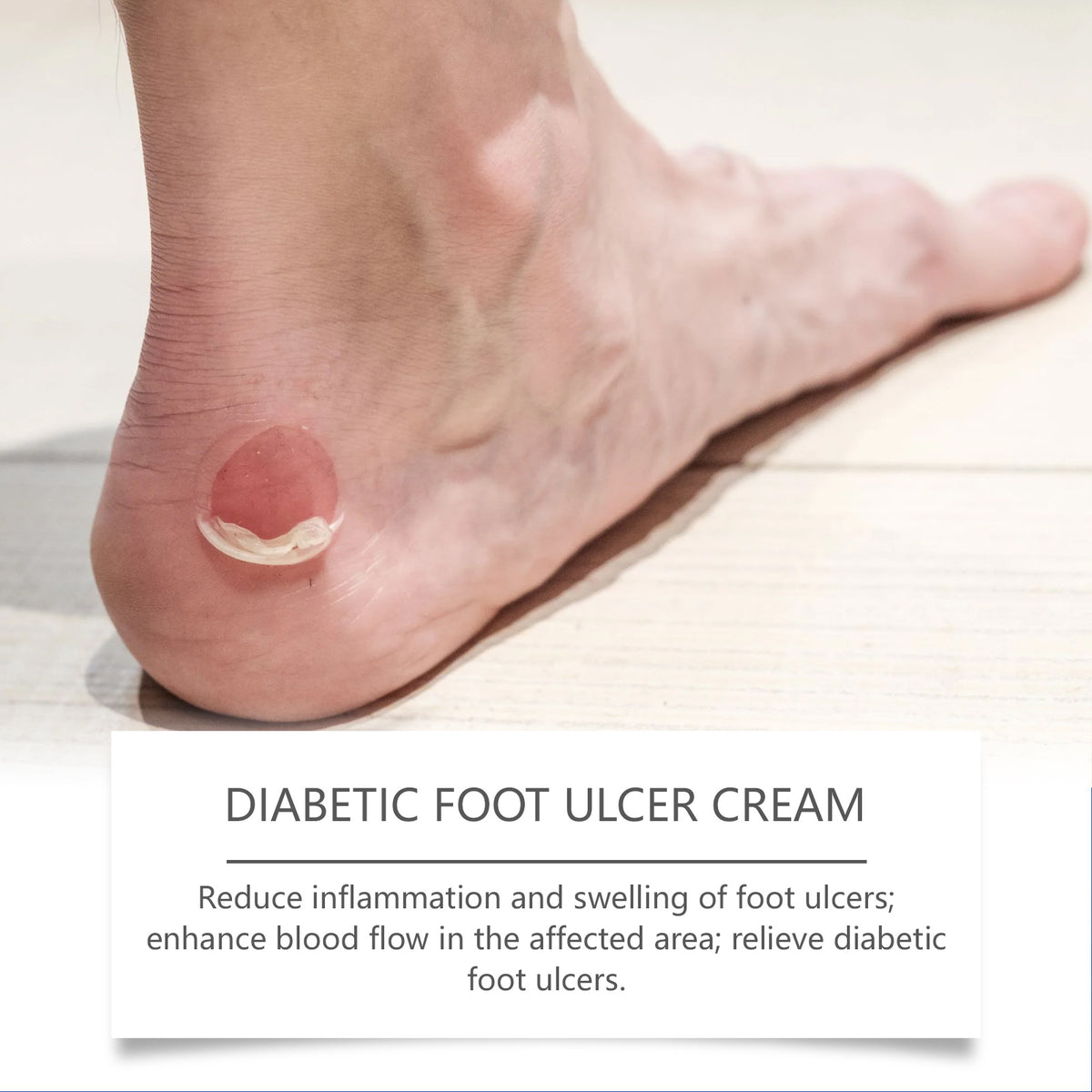 Nourishing Moisturizing Care Foot Relief Discomfort Massage Sole