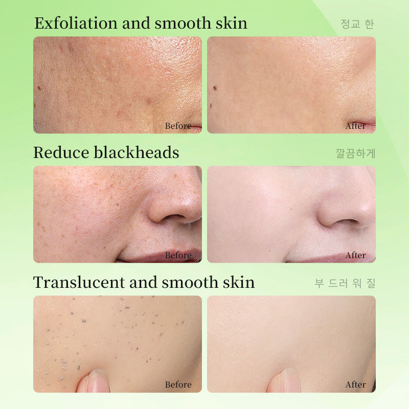 Whitening Exfoliating Gel 60g for Facial Care - Brightening Skincare Treatment