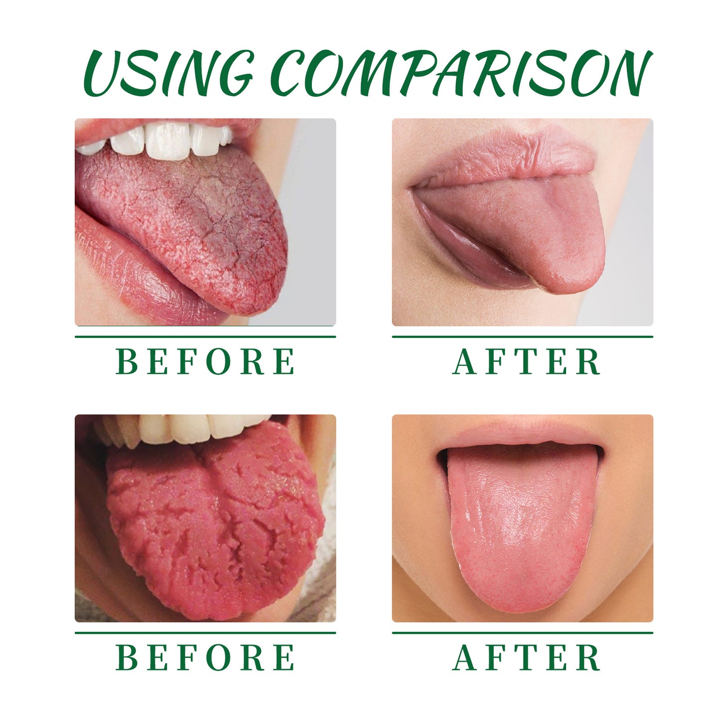 Tongue Repair Spray for Dry Mouth Relief and Oral Care