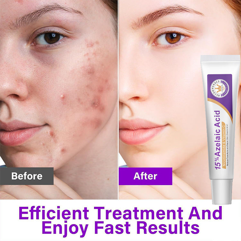 POSEEWORD 12percent Azelaic Acid