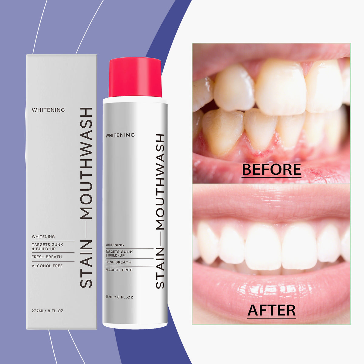 Whitening Mouthwash 237ml