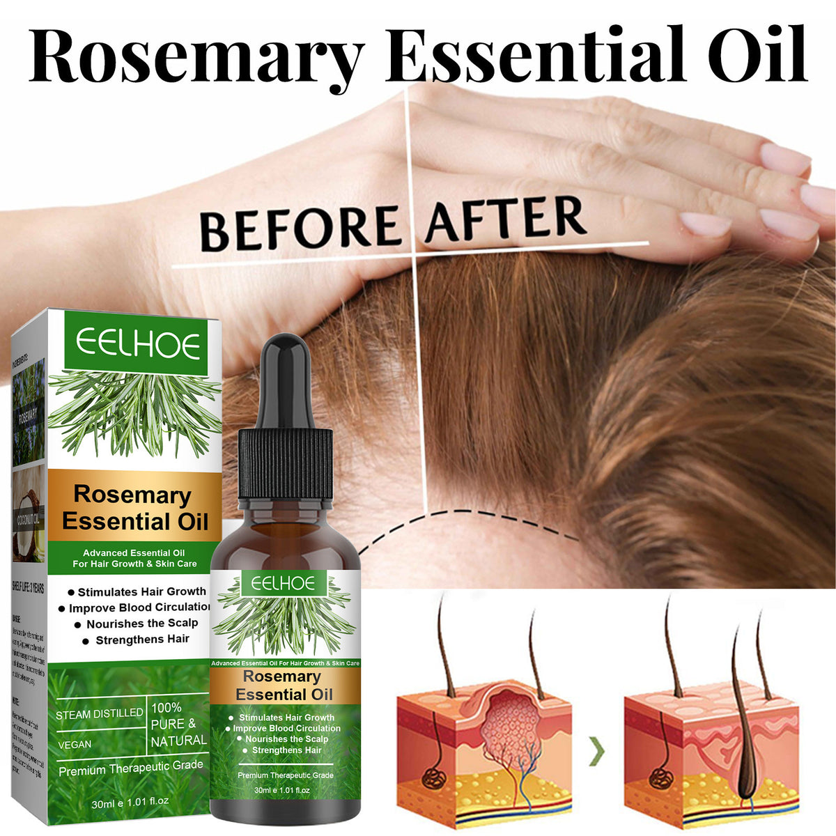 Rosemary Hair Growth Oil - Anti-Hair Loss Essential Oil 30ml