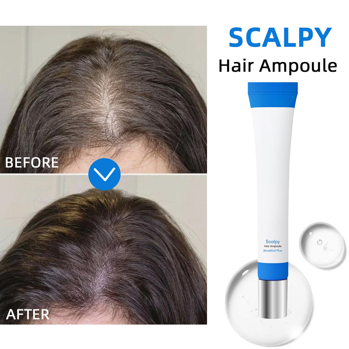 Non-standard Hair Growth Strong Root Dense Fixing Liquid