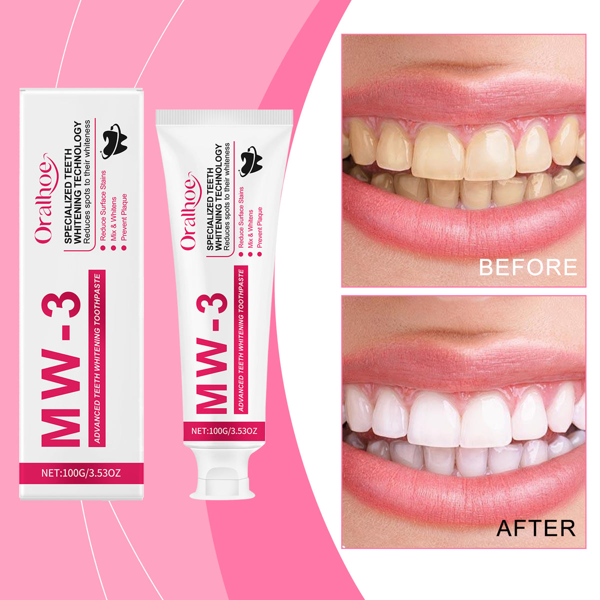 Whitening & Stain-Removing Toothpaste 100g