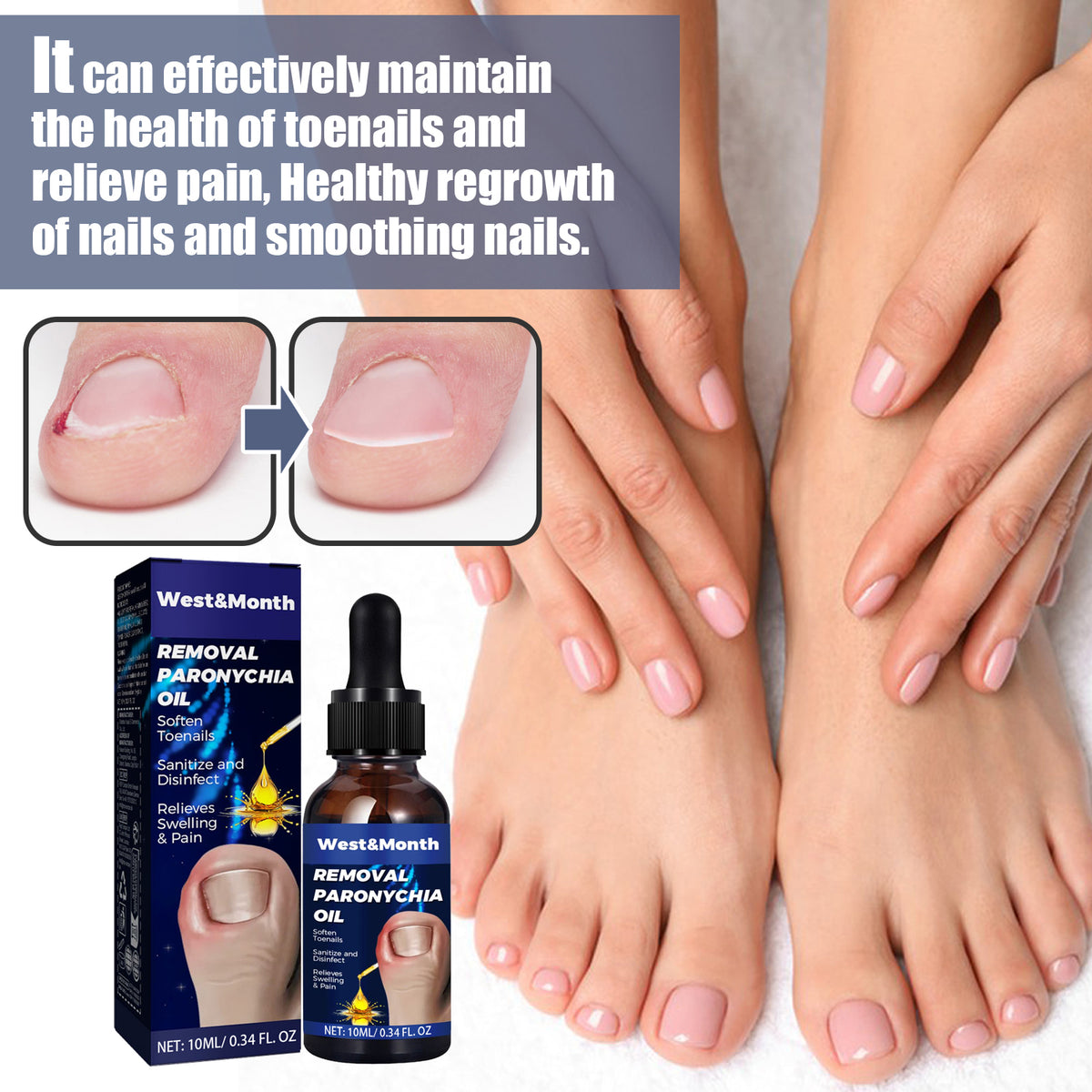 Nail Care Oil 10ml - Toenail & Cuticle Treatment