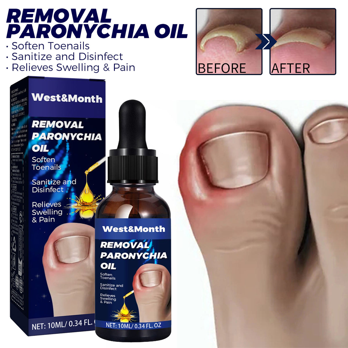 Nail Care Oil 10ml - Toenail & Cuticle Treatment