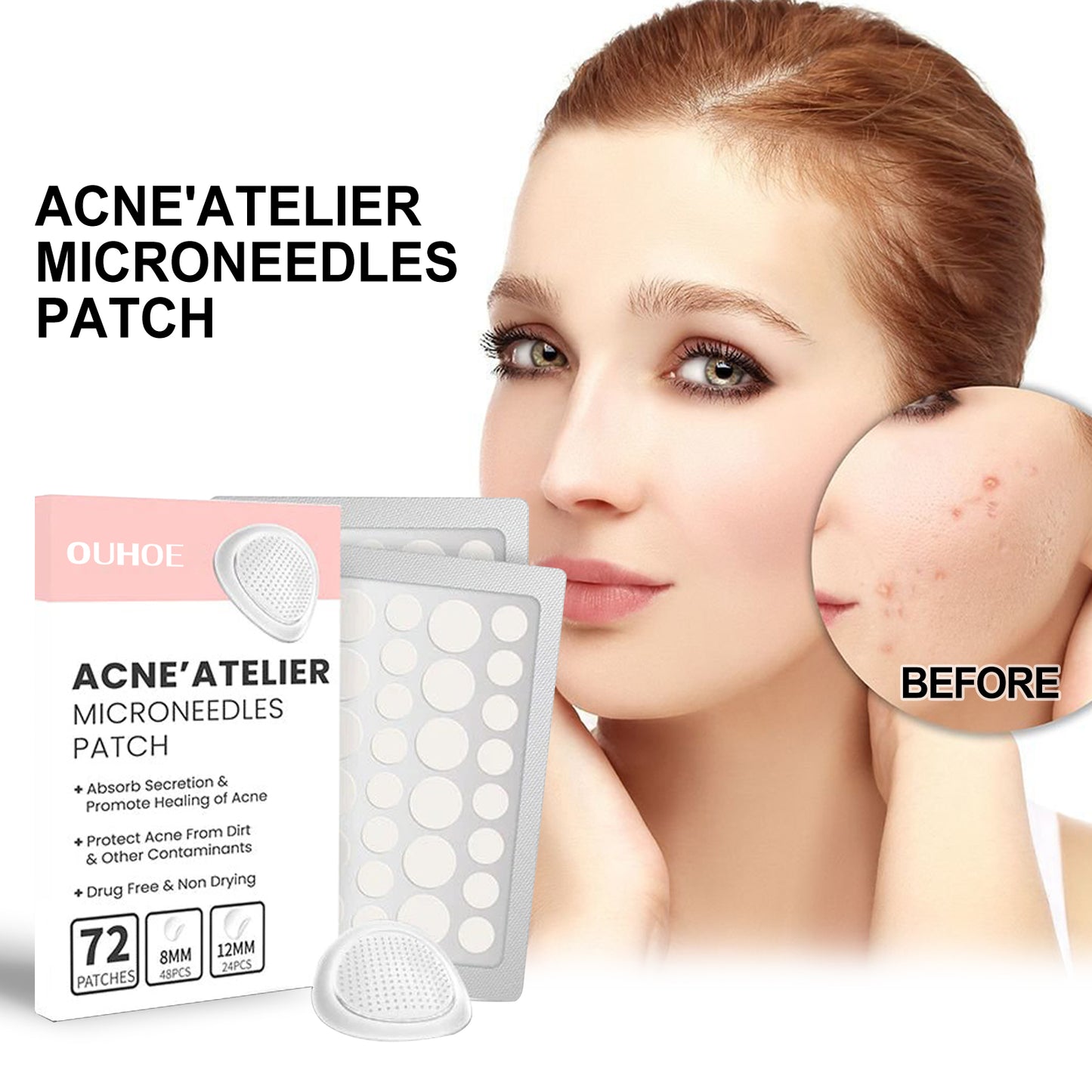 Acne Pimple Patch with Hyaluronic Acid & Vitamin B5 for Pore Cleansing