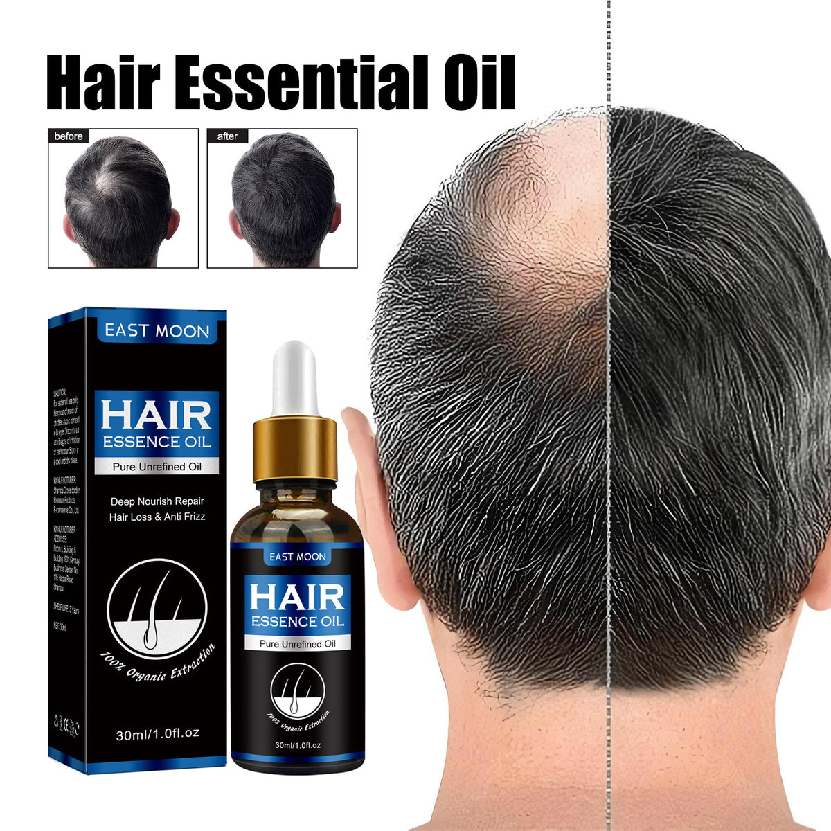 Dense Hair Essence Serum – Nutrition & Growth Support