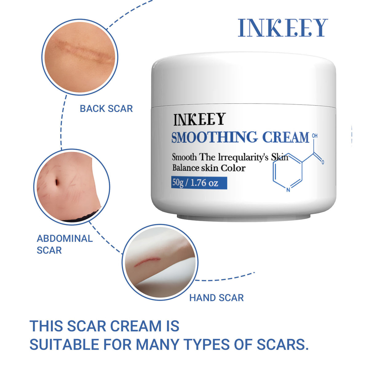 Skin Recovery Cream 50g for Scar & Skin Repair - Universal Face & Body Care