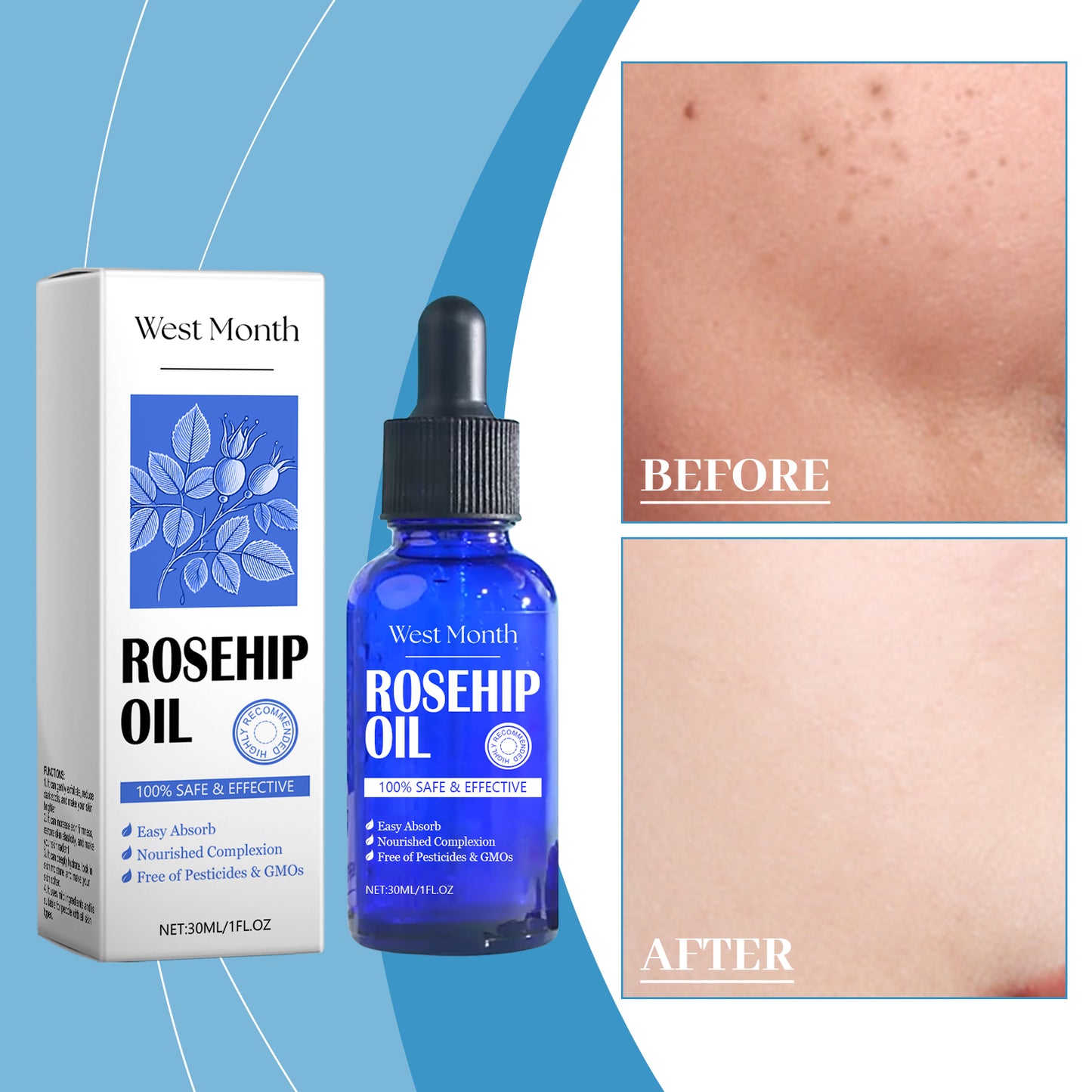 Rose Hip Essential Oil for Face - Moisturizing & Firming Skin Essence (30ml)