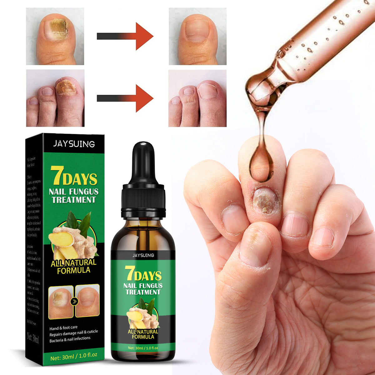 Ginger Nail Repair Lotion - Hand & Foot Moisturizing, 30ml