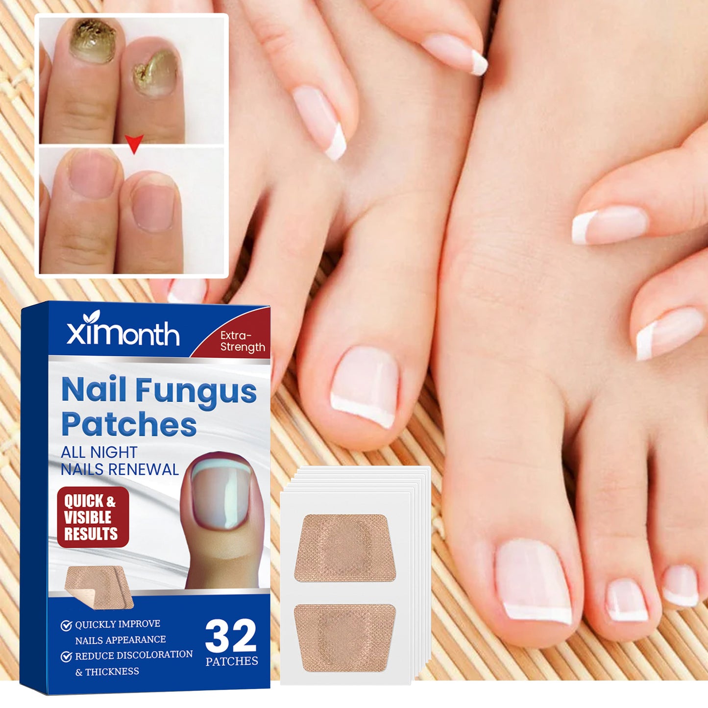 Nail Repair Adhesive Bandages Pack - 32 Patches for Nail Care