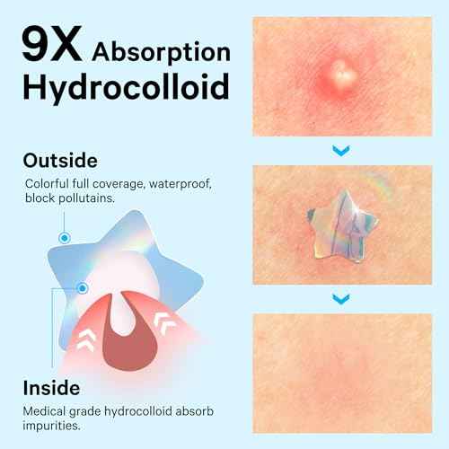 Sosky Hologram Pimple Patches for Face, Hydrocolloid Acne Patches with Salicylic Acid, Cute Star Zit Stickers,Colorful Blemish Covers,36 Count Blue Star Cloud Butterfly