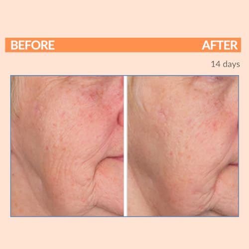 Serious Skincare Vitamin C & Collagen Night Skin Care Set - Reduce Wrinkles, Brightening - C-Restore Night Cream Moisturizer, Eye Treatment Gel & C Clean Face Cleanser - Deep Hydration C3 (3Pack)