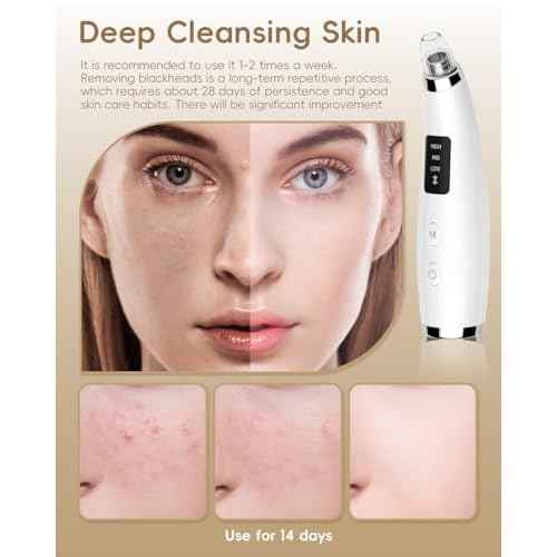 Facial Pore Blackhead Remover Vacuum - Fore Cleaner and Blackhead Extractor with 3 Adjustable Suction Levels - 5 Probes - Pore Vacuum Kit for Women&Men (White)