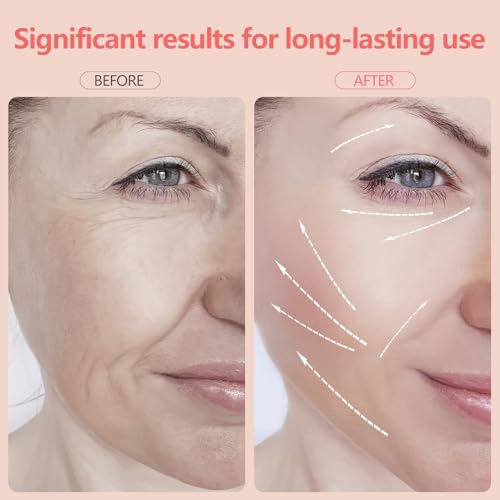 2025 New Face and Neck Massager Tool, 7 Colors LED Womens Skin Care Facial Massager for Skin Rejuvenation, Lifting, Toning, Glow Boost-White