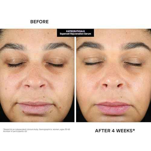 Kate Somerville KateCeuticals® SuperCell – Rejuvenation Peptide Serum to Repair Damaged Skin and Reduce Fine Lines and Wrinkles, 1 Fl Oz