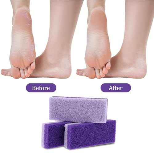 6pcs Foot Stone Pumice,Heel Scrubber,Foot Pumice Stone for Feet Skin Callus Remover and Scrubber£¨Purple£©