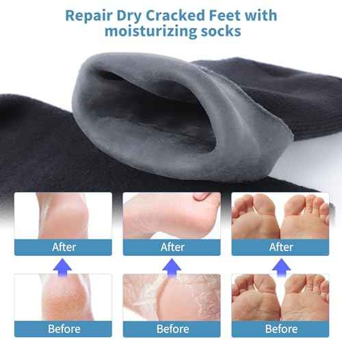 11" Large Silicone Moisturizing Socks for Men - 2 Pairs Soft Foot Care Socks - Feet Moisturizing Socks for Dry Cracked Feet (Size L)