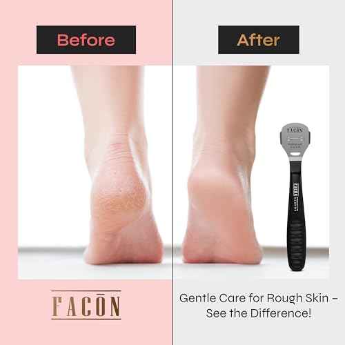 Fac?n Professional Callus Shaver Remover with 50 Blades, Pedicure Razor for Feet & Hands, Foot Razor for Callus Removal, Callus Blade Remover, Corn Shaver, Surgical Grade Premium Stainless Steel Tool