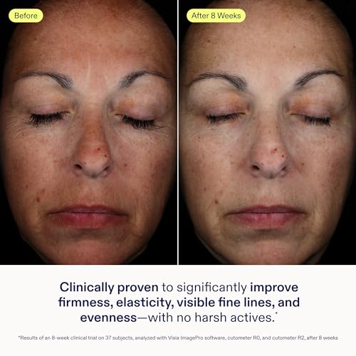 Skinfix Exo + Ectoin Intensive Repair Baume - 1 oz - Retinol-Free Face Serum with Hyaluronic Acid, Peptides - Visibly Smooths Wrinkles, Evens Dark Spots & Redness - Fragrance Free, Vegan, Cruelty Free