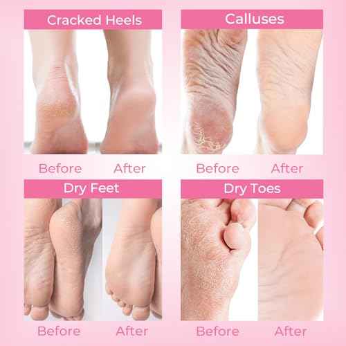 Foot Peeling Mask, 4 Pairs Foot Peel Mask for Dry Cracked Feet, Dead Skin Callus Removal, Repair Soft Feet
