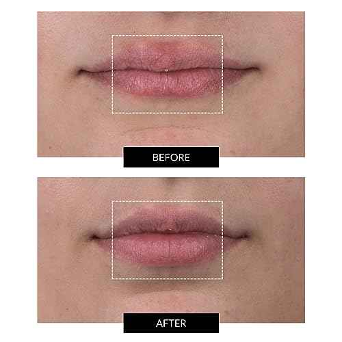 CurrentBody Skin LED Lip Perfector | Fully Wearable Anti-Aging Device for Lips | Soften Feather and Smile Lines for Plumper and Fuller Lips
