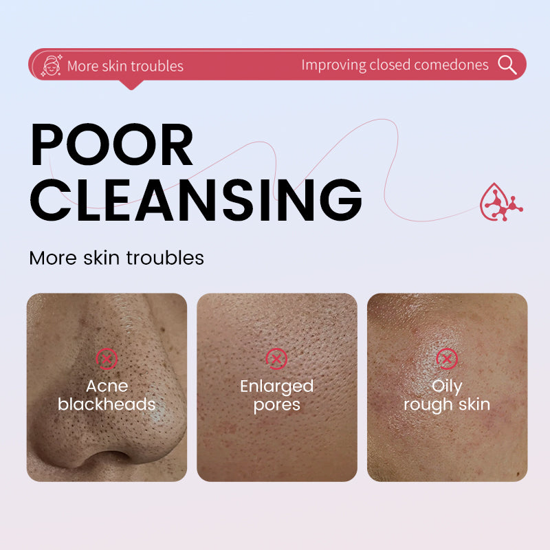 Volcanic Mud Cleansing Stick - 40g Blackhead & Pore Refiner