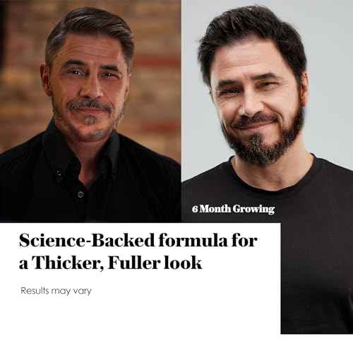 Minoxidil Beard Growth Oil: Minoxidil For Men Beard Infused With Biotin, Extra Strength Minoxidil 5% Beard Growth Serum to Grow Beard & Mustache Fast