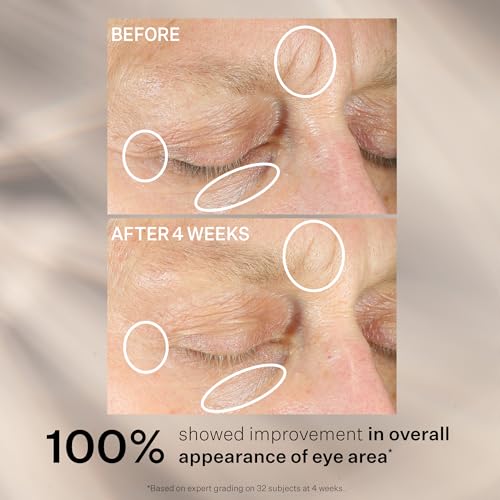 StriVectin Anti-Wrinkle Intensive Eye Cream Concentrate for Wrinkles PLUS, Targets Crow's Feet, Firmness, Puffiness & Dark Circle