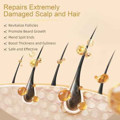 5% Minoxidil for Women Hair Growth - Hair Regrowth Treatment for Men and Women - Minoxidil Hair Growth Serum for Fuller, Thicker Hair