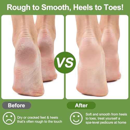 Pumice Stone for Feet, 3 Pack Natural Earth Lava Foot Callus Remover & Pedicure Exfoliator Tools for Heels, Soles and Toe Gaps, Foot Scrubber for Dry & Dead Skin