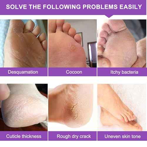 Foot Peeling Mask 5 Pack, Moisturizing Socks for Dry Foot Care, Hydrating Feet Peel Masks Repair Dry Cracked Heels, Remove Dead Skin,Callus - Women Men (Lavender)
