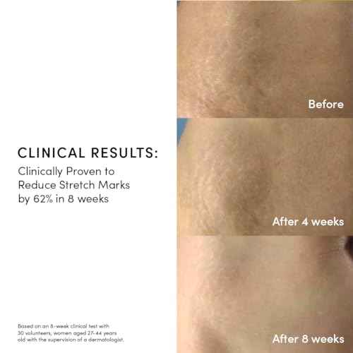 Evereden Golden Belly Serum, 1.7 fl oz. | Clean & Vegan Women's Belly Oil for Pregnancy and Postpartum | Clean Maternity Skincare | Non-Toxic Stretch Mark Oil