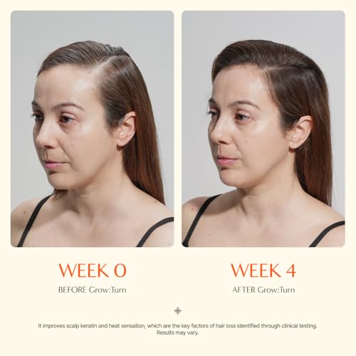 Growturn Hair Growth Serum with Built in Brush for Hair Growth & Thickening | Treatment for Thinning Hair, Hair Loss | Low Irritation, Fragrance-Free, Sulfate & Paraben-Free, 3.38 fl. oz. (Pack of 1)