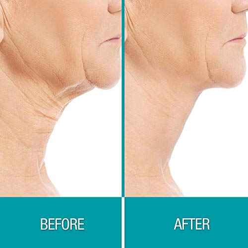 Dermactin Crepe Be Gone Firming Neck Cream