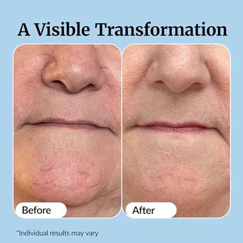 Vibriance Super C Serum for Mature Skin - All-in-One Vitamin Formula Hydrates, Firms, Lifts, Smooths, Targets Age Spots, Wrinkles, 1 fl oz