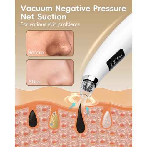 Facial Pore Blackhead Remover Vacuum - Fore Cleaner and Blackhead Extractor with 3 Adjustable Suction Levels - 5 Probes - Pore Vacuum Kit for Women&Men (White)