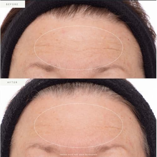 KORA Organics Plant Stem Cell Retinol Alternative Serum, Firming Face Serum, Repair Signs of Aging, Promotes Radiant Skin, Certified Organic, Cruelty Free - Smoothening Retinol for Face - 1.01 fl oz