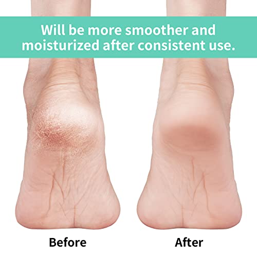 Vaincre Gel Moisturizing Heel Socks for Dry Cracked Feet Women, 4 Pairs Foot Care Spa Moisture Toeless Socks for Cracked Heel Repair Treatment Overnight (Regular)