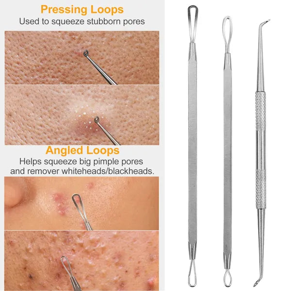 7-Piece Blackhead Remover Kit - Stainless Steel Pimple & Acne Extractor